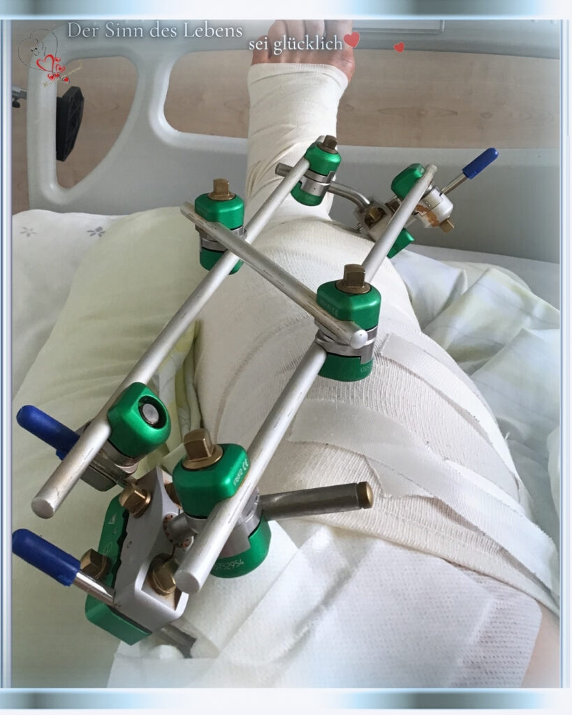 Schmerzlöser-Affirmation - Bein nach dem Unfall